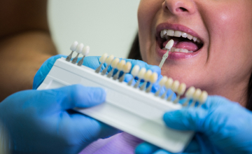 Scaling and Root Planing